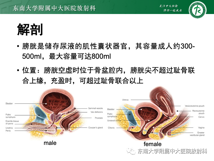 【PPT】腺性膀胱炎-6