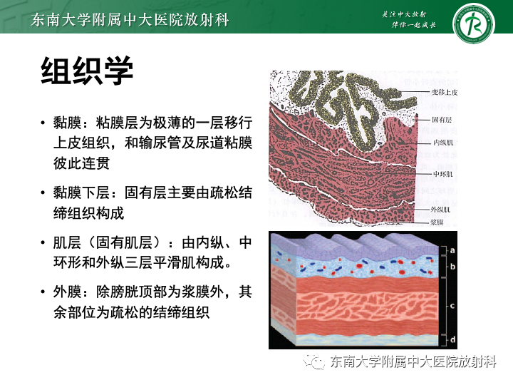 【PPT】腺性膀胱炎-8