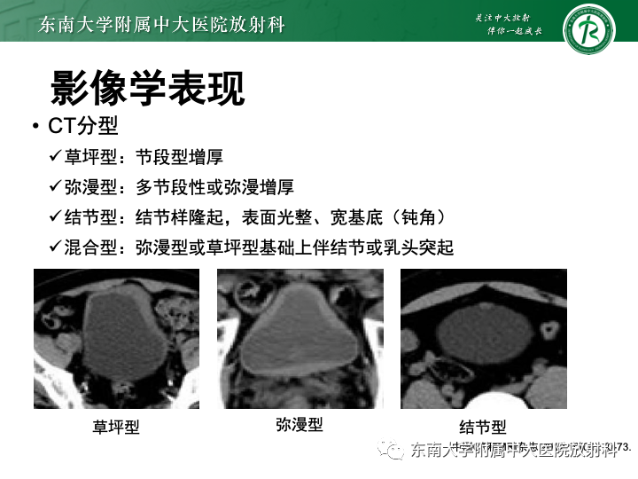 【PPT】腺性膀胱炎-17