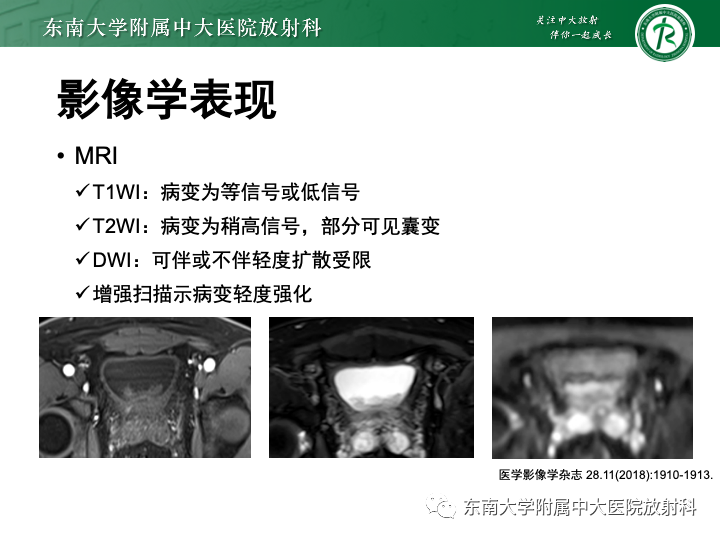 【PPT】腺性膀胱炎-18
