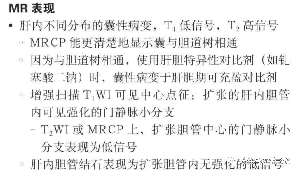 肝内胆管错构瘤和先天性肝内胆管囊状扩张症（Caroli病）-10