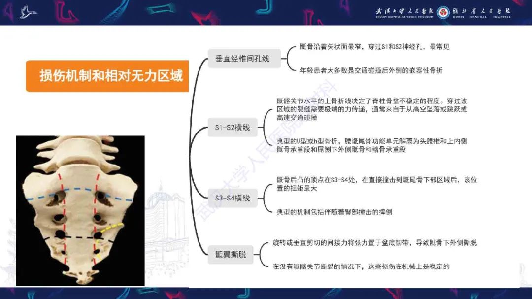 【PPT】骶骨骨折CT评估-5