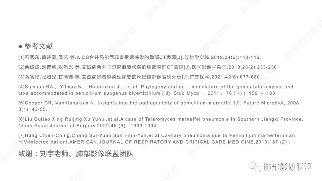 【PPT】马尔尼菲篮状菌的CT表现-21 【PPT】马尔尼菲篮状菌的CT表现-21