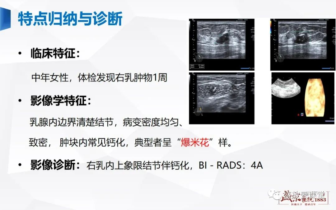 【PPT】乳腺疾病病例读片-16 【PPT】乳腺疾病病例读片-16