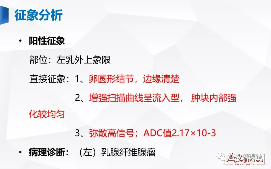 【PPT】乳腺疾病病例读片-19 【PPT】乳腺疾病病例读片-19