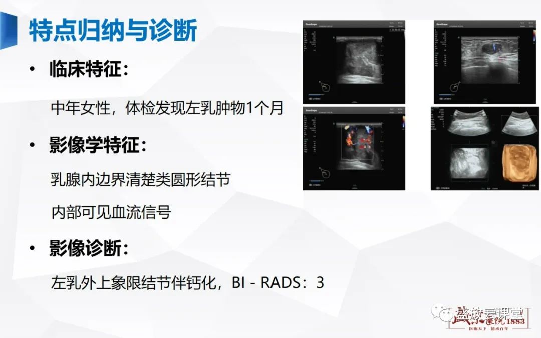 【PPT】乳腺疾病病例读片-20 【PPT】乳腺疾病病例读片-20