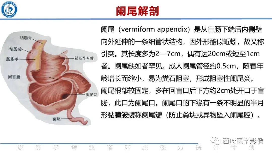 【PPT】阑尾解剖及阑尾炎影像诊断-2