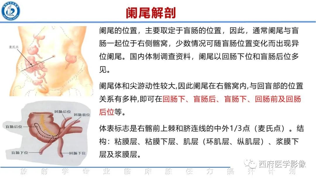 【PPT】阑尾解剖及阑尾炎影像诊断-3