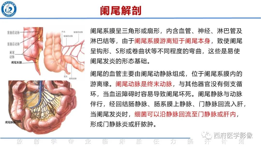 【PPT】阑尾解剖及阑尾炎影像诊断-4
