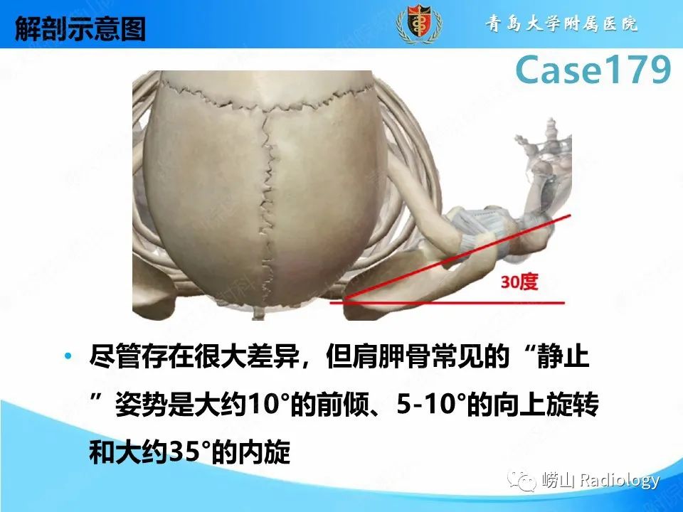 【PPT】肩胛胸壁分离-13