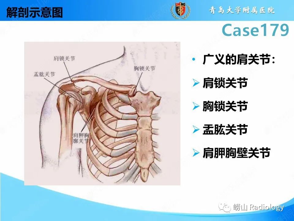 【PPT】肩胛胸壁分离-15