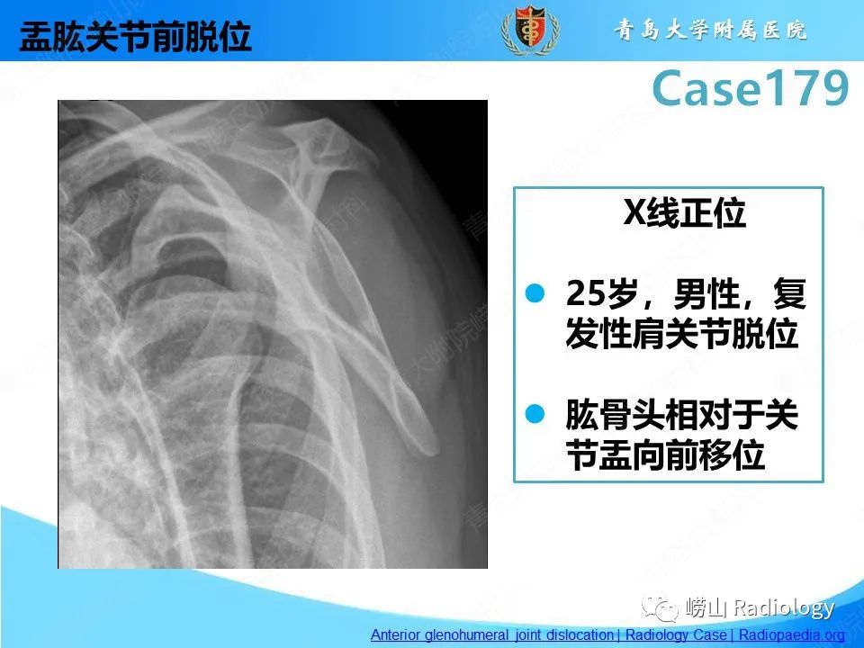 【PPT】肩胛胸壁分离-24