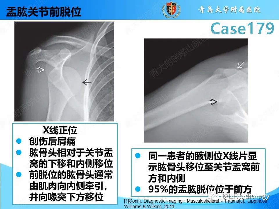 【PPT】肩胛胸壁分离-25