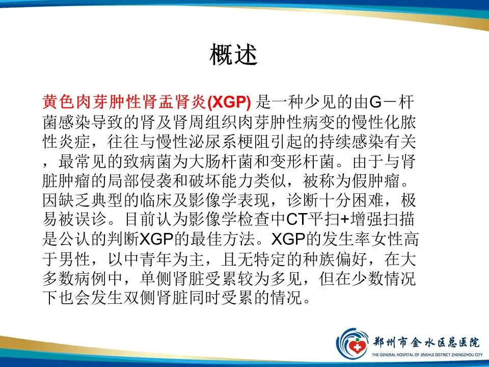 【PPT】黄色肉芽肿性肾盂肾炎影像表现-2