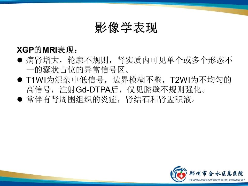 【PPT】黄色肉芽肿性肾盂肾炎影像表现-27