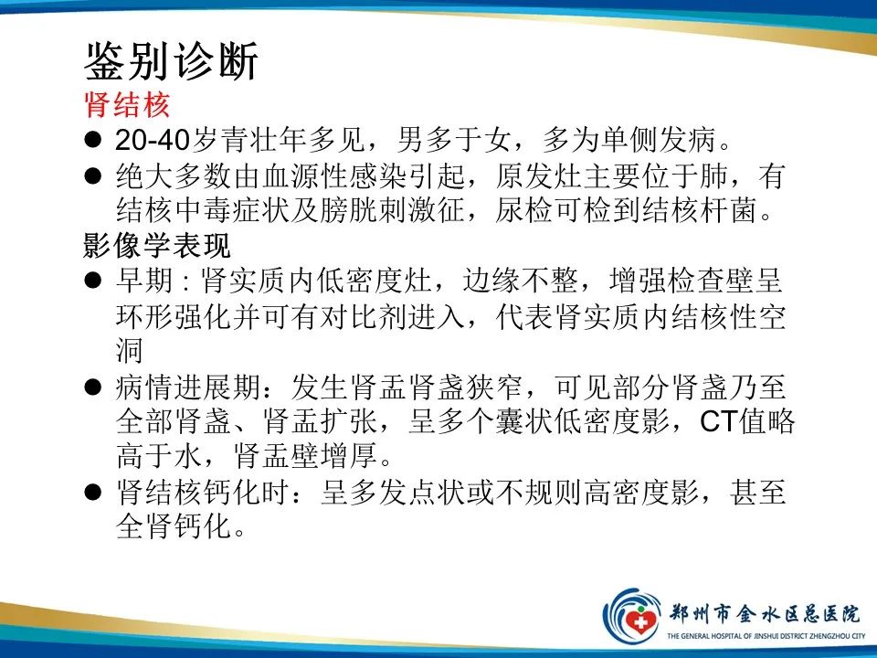 【PPT】黄色肉芽肿性肾盂肾炎影像表现-29