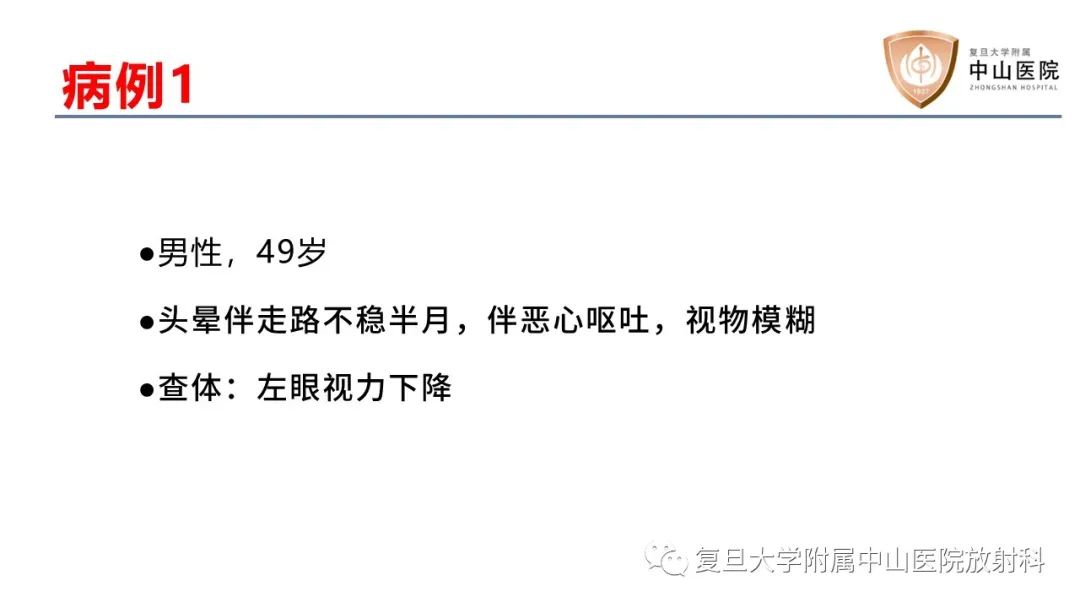 【病例】成人四脑室髓母细胞瘤2例CT及MR-2