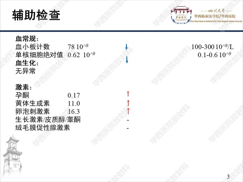 【PPT】颅咽管瘤1例MR影像鉴别诊断-3