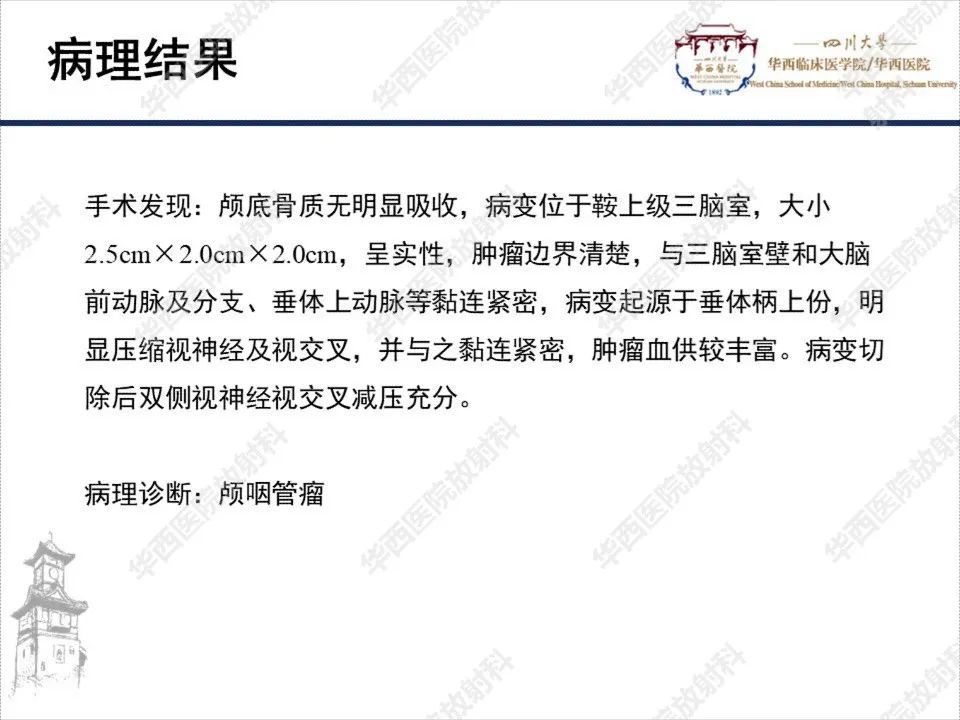 【PPT】颅咽管瘤1例MR影像鉴别诊断-7
