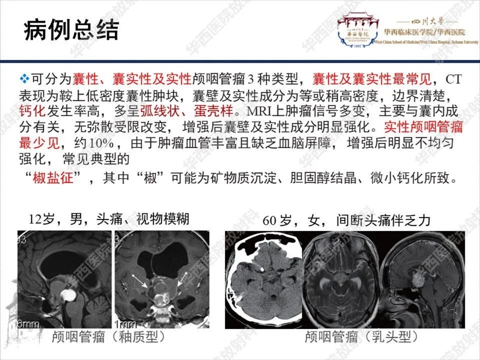 【PPT】颅咽管瘤1例MR影像鉴别诊断-10
