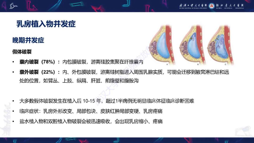 【PPT】隆胸术后并发症MRI诊断-23