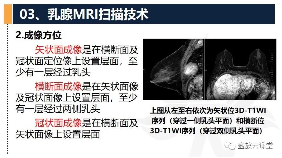 【PPT】乳腺磁共振检查技术-11
