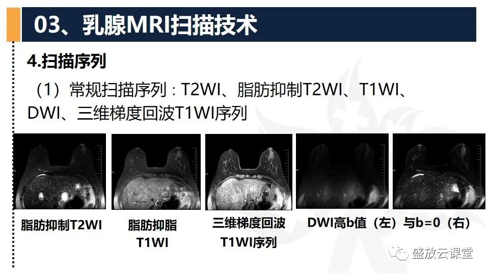 【PPT】乳腺磁共振检查技术-14