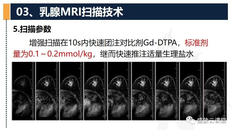 【PPT】乳腺磁共振检查技术-17