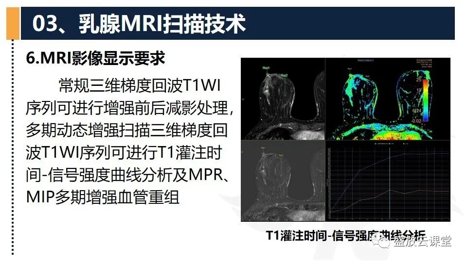 【PPT】乳腺磁共振检查技术-18