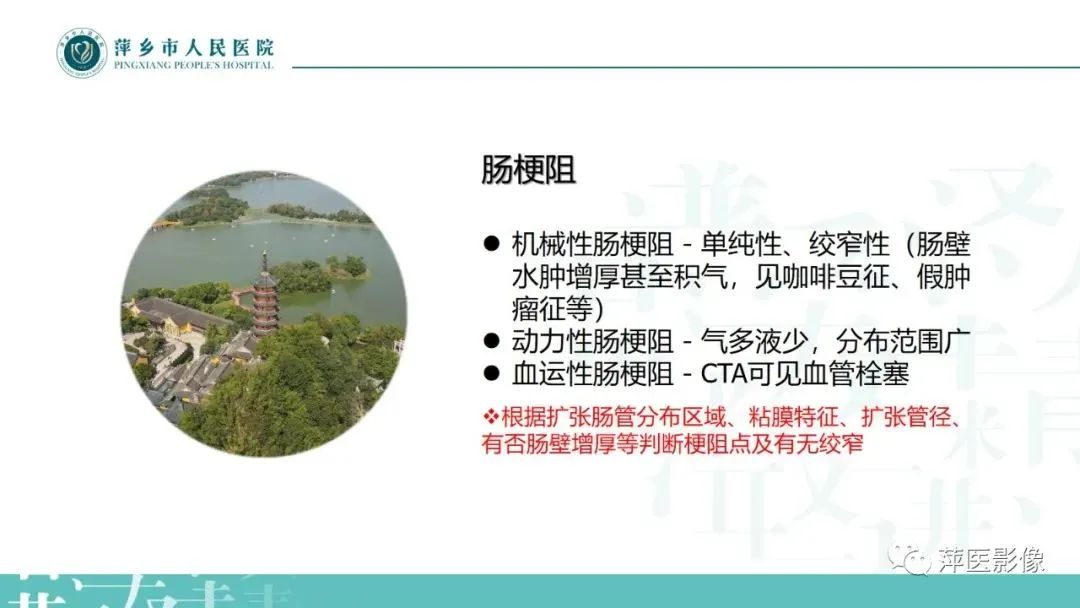 【PPT】腹部X线基础影像-18