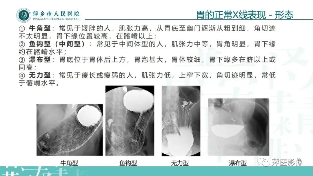 【PPT】腹部X线基础影像-29