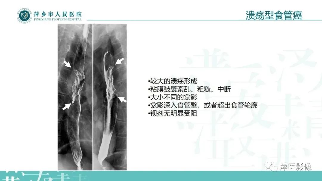 【PPT】腹部X线基础影像-53