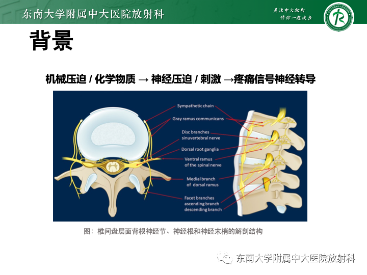 【PPT】下腰痛相关疾病的影像表现-4