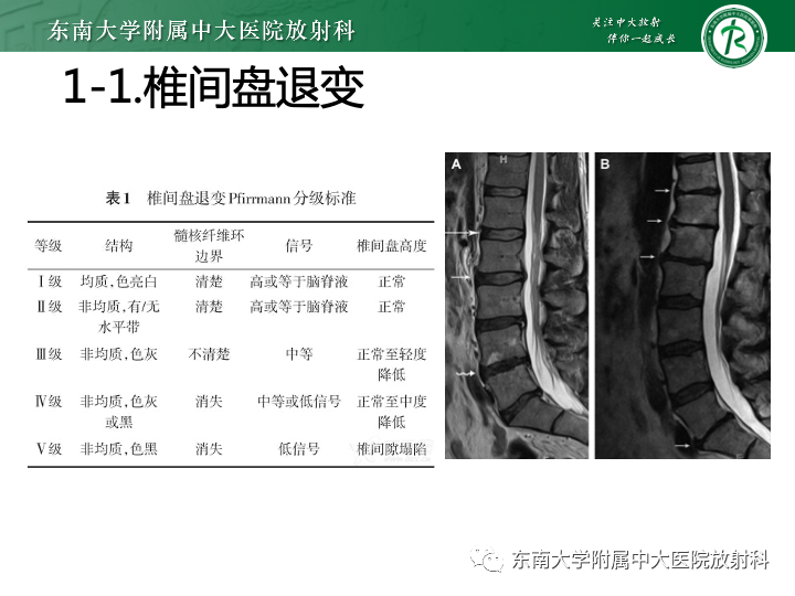 【PPT】下腰痛相关疾病的影像表现-7