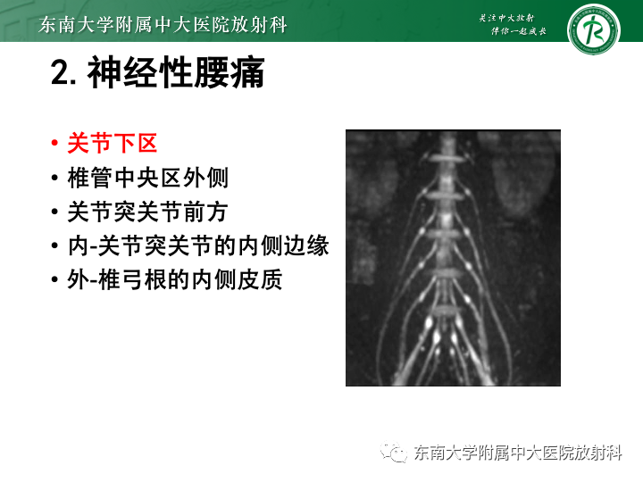 【PPT】下腰痛相关疾病的影像表现-21