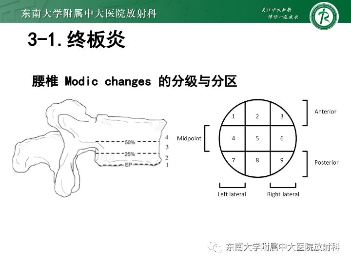 【PPT】下腰痛相关疾病的影像表现-35