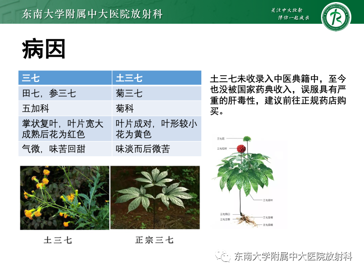 【PPT】肝窦阻塞综合征-8