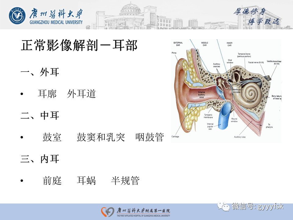 【PPT】中耳胆脂瘤影像阅片-3