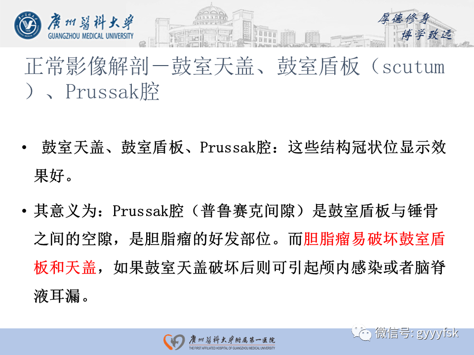 【PPT】中耳胆脂瘤影像阅片-8