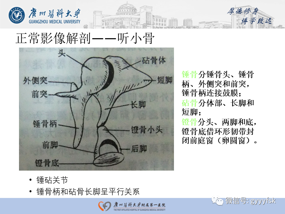 【PPT】中耳胆脂瘤影像阅片-11