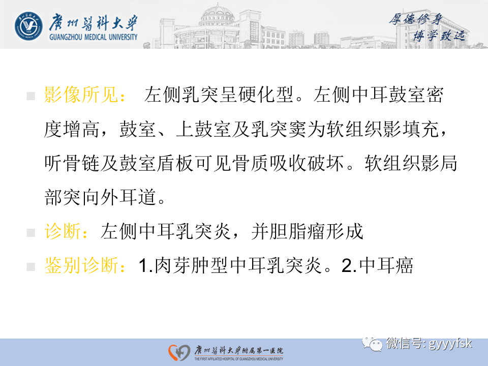 【PPT】中耳胆脂瘤影像阅片-21