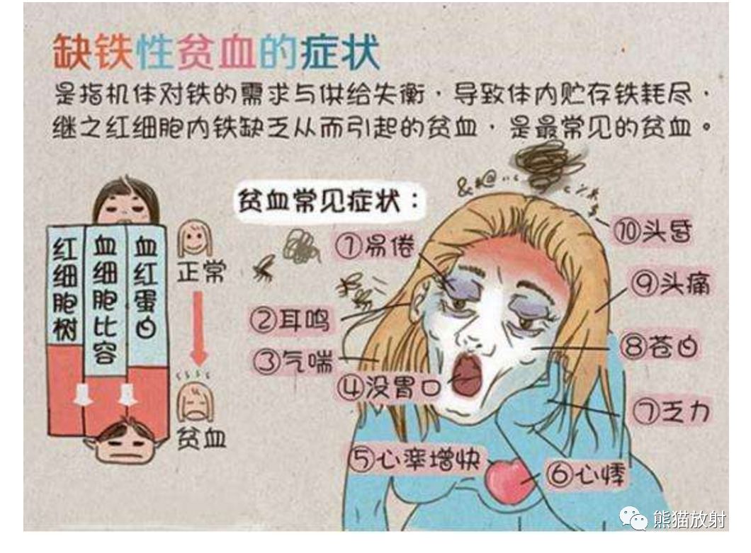 贫血—胸部CT平扫的诊断价值-4