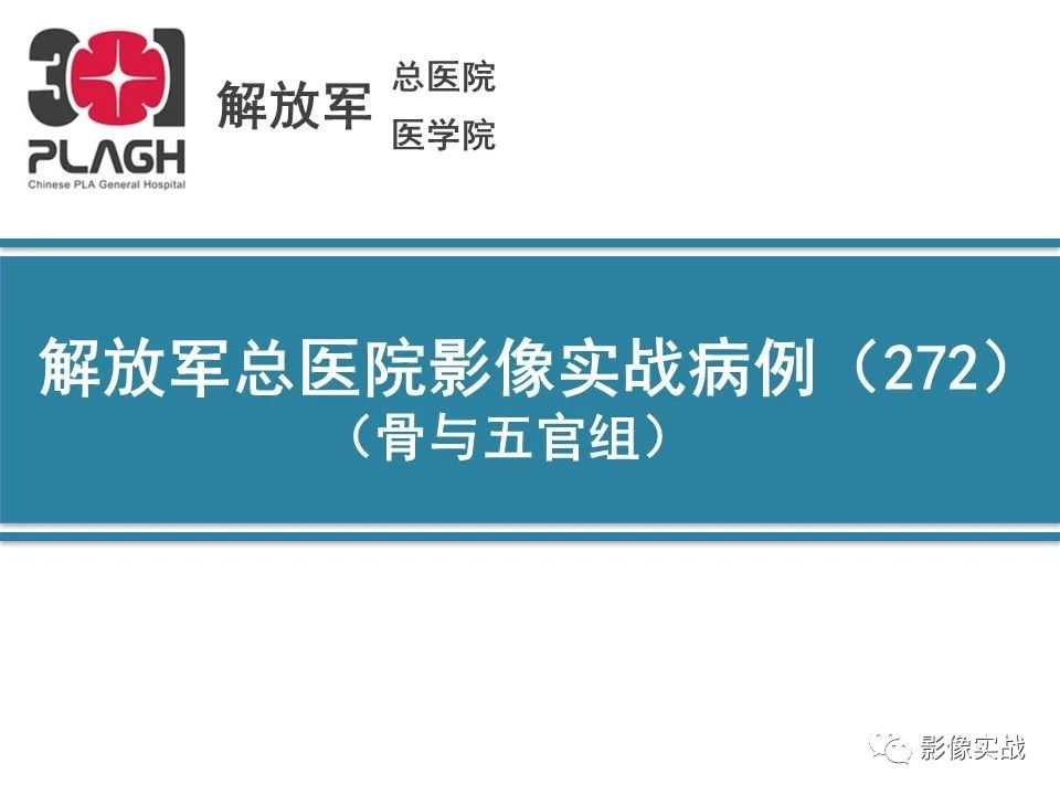 【病例】颈椎脊索瘤1例MR影像-1