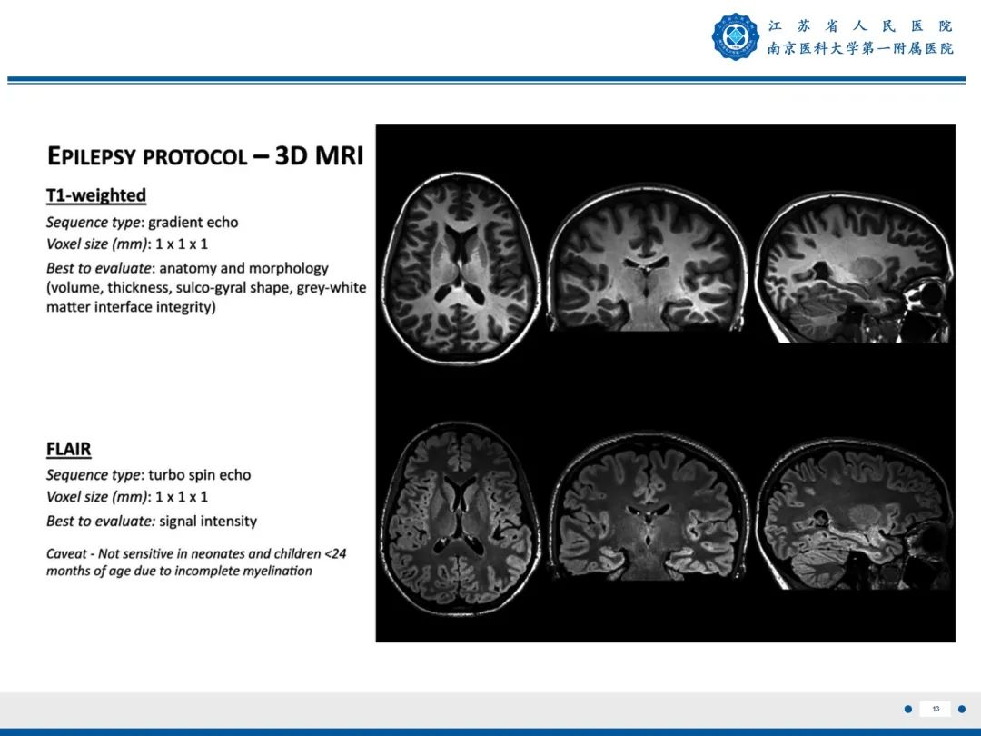 【PPT】​海马硬化-14