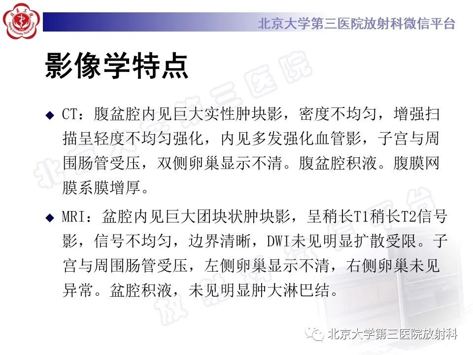 【PPT】卵巢纤维-卵泡膜细胞瘤-5