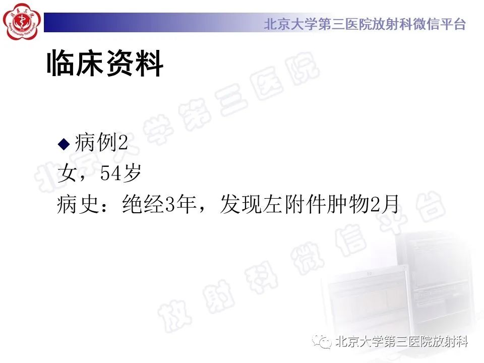 【PPT】卵巢纤维-卵泡膜细胞瘤-8