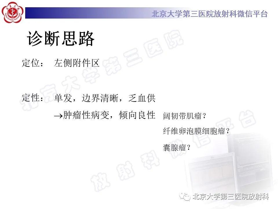 【PPT】卵巢纤维-卵泡膜细胞瘤-12