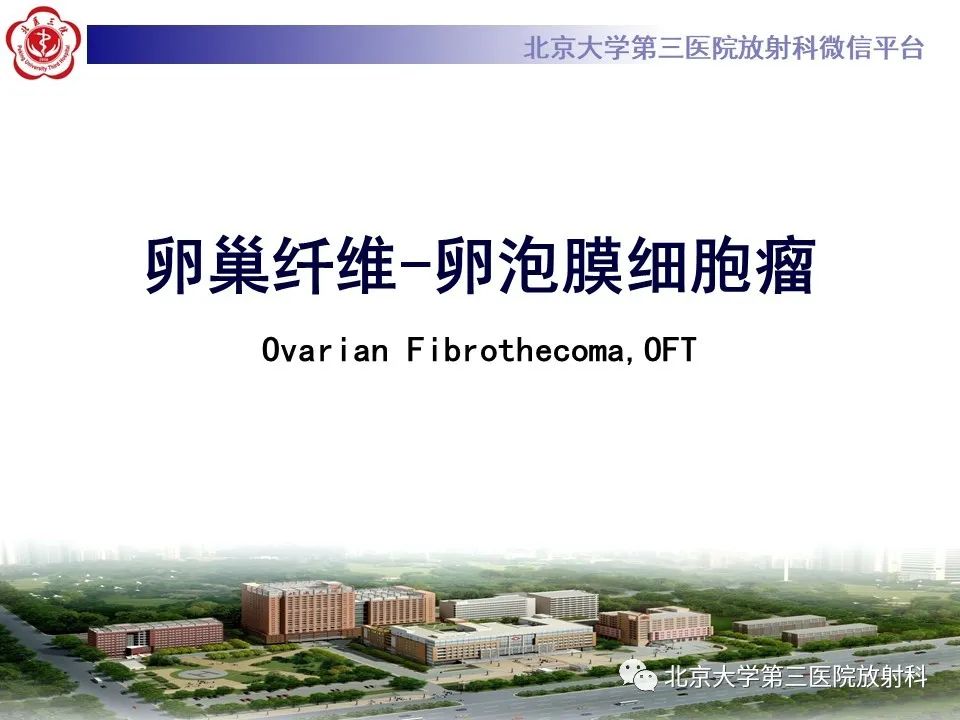 【PPT】卵巢纤维-卵泡膜细胞瘤-14