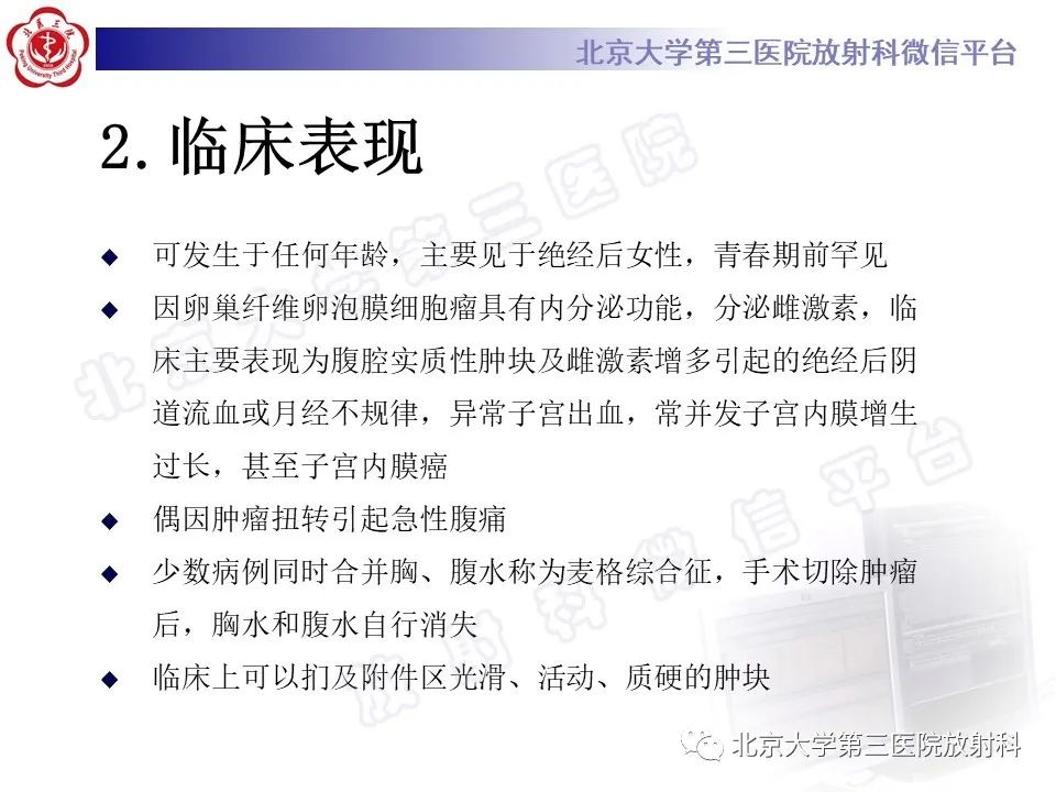 【PPT】卵巢纤维-卵泡膜细胞瘤-16