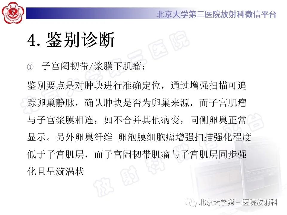 【PPT】卵巢纤维-卵泡膜细胞瘤-19